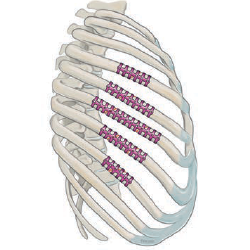 Rib clips